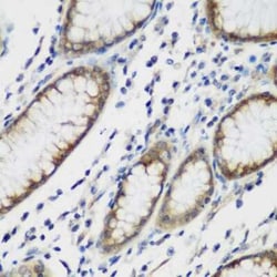 Tau tubulin kinase 2 Antibody - BSA Free, Novus Biologicals 0.1 mL, Unconjugated:Antibodies,