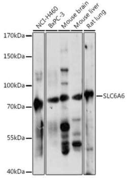 TauT/SLC6A6 Antibody - Azide and BSA Free, Novus Biologicals 0.02 mL; Unconjugated:Antibodies,