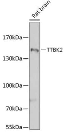Tau tubulin kinase 2 Antibody - BSA Free, Novus Biologicals 0.1 mL, Unconjugated:Antibodies,