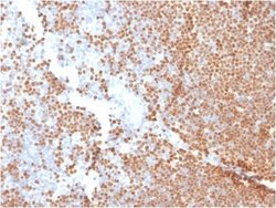TdT Antibody (DNTT/1453) - Azide and BSA Free, Novus Biologicals 100 &mu;g | Buy Online | Novus Biologicals | Fisher Scientific