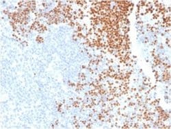 TdT Antibody (DNTT/1453) - Azide and BSA Free, Novus Biologicals 100 &mu;g | Buy Online | Novus Biologicals | Fisher Scientific
