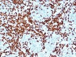 TdT Antibody (DNTT/4506R) - Azide and BSA Free, Novus Biologicals 100 &mu;g;