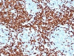 TdT Antibody (DNTT/4506R) - Azide and BSA Free, Novus Biologicals 100 &mu;g;