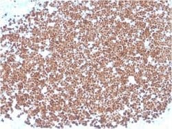 TdT Mouse anti-Human, Clone: TDT/1393, Novus Biologicals:Antibodies:Primary