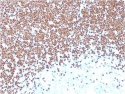 TdT Mouse anti-Human, Clone: TDT/1393, Novus Biologicals:Antibodies:Primary