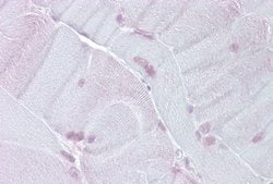 Tef Rabbit anti-Human, Polyclonal, Novus Biologicals 0.1ml; Unconjugated:Antibodies,