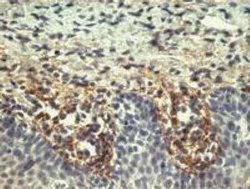 Tenascin C Antibody (T2H5) - BSA Free, Novus Biologicals 0.1 mg | Buy Online | Novus Biologicals | Fisher Scientific