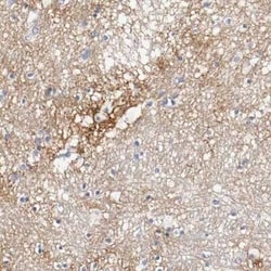 Tenascin C Antibody, Novus Biologicals 25 &mu;L | Buy Online | Novus Biologicals | Fisher Scientific