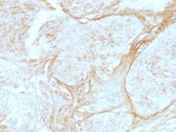 Tenascin C Antibody (SPM319), Novus Biologicals:Antibodies:Primary Antibodies