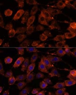 Teneurin-1 Antibody - Azide and BSA Free, Novus Biologicals 0.1 mL, Unconjugated:Antibodies,