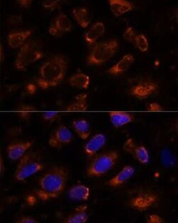 Teneurin-1 Antibody - Azide and BSA Free, Novus Biologicals 0.1 mL, Unconjugated:Antibodies,