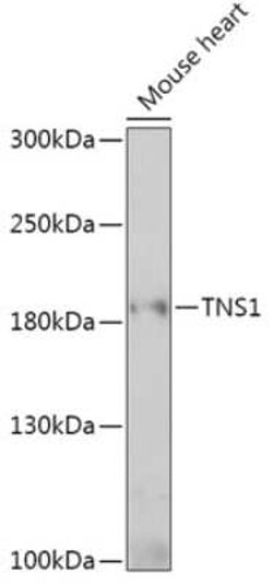 Tensin 1 Antibody - Azide and BSA Free, Novus Biologicals:Antibodies:Primary