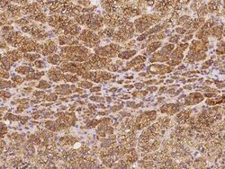 Testis expressed 264 Antibody, Novus Biologicals 50 &mu;g, Unconjugated:Antibodies,