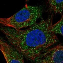 Testis expressed 38 Rabbit anti-Human, Polyclonal, Novus Biologicals:Antibodies:Primary