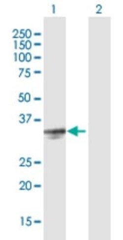 Testisin/Prss21 Antibody, Novus Biologicals 50 &mu;g | Buy Online | Novus Biologicals | Fisher Scientific