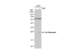 TetR Antibody, Novus Biologicals 100 &mu;g | Buy Online | Novus Biologicals | Fisher Scientific