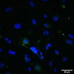 TfR (Transferrin R) Antibody (8D3) - Azide and BSA Free, Novus Biologicals:Antibodies:Primary