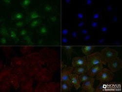 TfR (Transferrin R) Antibody (OX26) - Azide and BSA Free, Novus Biologicals