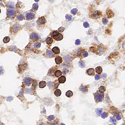 TfR (Transferrin R) Antibody (OX26) - Azide and BSA Free, Novus Biologicals
