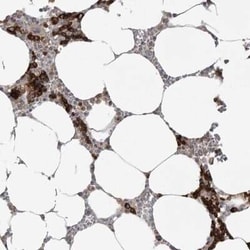TfR (Transferrin R) Antibody, Novus Biologicals 25 &mu;L; Unconjugated:Antibodies,