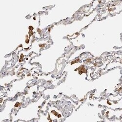 TfR (Transferrin R) Antibody, Novus Biologicals 25 &mu;L; Unconjugated:Antibodies,