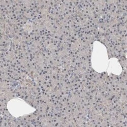 TfR (Transferrin R) Antibody, Novus Biologicals 25 &mu;L; Unconjugated:Antibodies,