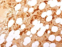 TfR (Transferrin R) Antibody (TFRC/1817) - Azide and BSA Free, Novus Biologicals:Antibodies:Primary