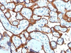 TfR (Transferrin R) Antibody (TFRC/1817) - Azide and BSA Free, Novus Biologicals:Antibodies:Primary