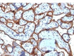 TfR (Transferrin R) Antibody (TFRC/1818), Novus Biologicals:Antibodies:Primary