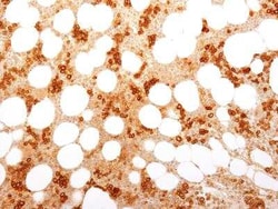 TfR (Transferrin R) Antibody (TFRC/1818), Novus Biologicals:Antibodies:Primary