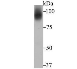 TfR2 Rabbit anti-Human, Clone: JG58-34, Novus Biologicals 100 &mu;g; Unconjugated:Antibodies,