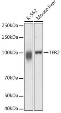 TfR2 Antibody - Azide and BSA Free, Novus Biologicals 0.1 mL, Unconjugated:Antibodies,
