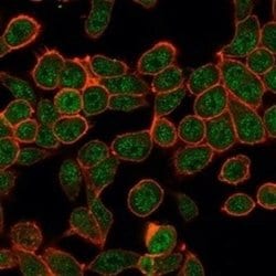 Th-POK Mouse anti-Human, Clone: PCRP-ZBTB7B-1F7, Novus Biologicals:Antibodies:Primary