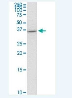 Th-POK Antibody (1D4), Novus Biologicals 100 &mu;g | Buy Online | Novus Biologicals | Fisher Scientific