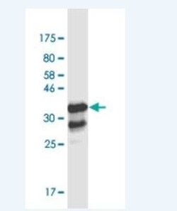 Th-POK Antibody (1D4), Novus Biologicals 100 &mu;g | Buy Online | Novus Biologicals | Fisher Scientific