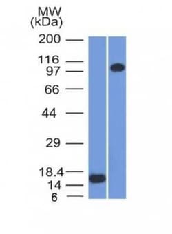 Thrombomodulin/BDCA-3 Antibody (THBD/1591), Novus Biologicals:Antibodies:Primary