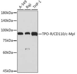 Thrombopoietin R/Tpo R Rabbit anti-Human, Mouse, Rat, Clone: 5Q9Z6, Novus