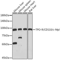 Thrombopoietin R/Tpo R Rabbit anti-Human, Mouse, Rat, Clone: 5Q9Z6, Novus