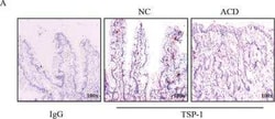 Thrombospondin-1 Antibody (A6.1), Novus Biologicals:Antibodies:Primary