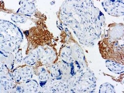 Thrombospondin-1 Antibody (A6.1), Novus Biologicals:Antibodies:Primary