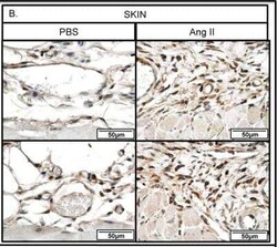 Thrombospondin-1 Antibody (A6.1), Novus Biologicals:Antibodies:Primary