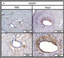 Thrombospondin-1 Antibody (A6.1), Novus Biologicals:Antibodies:Primary