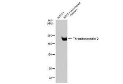 Thrombospondin-2 Antibody (GT147), Novus Biologicals 100 &mu;g | Buy Online | Novus Biologicals | Fisher Scientific