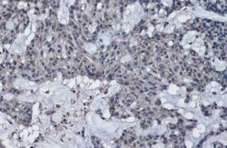 Thrombospondin-2 Antibody, Novus Biologicals 100 &mu;g | Buy Online | Novus Biologicals | Fisher Scientific