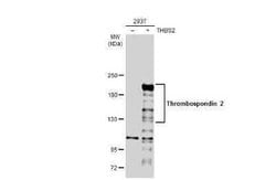 Thrombospondin-2 Antibody, Novus Biologicals 100 &mu;g | Buy Online | Novus Biologicals | Fisher Scientific