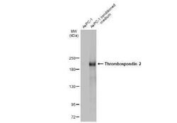 Thrombospondin-2 Antibody, Novus Biologicals 100 &mu;g | Buy Online | Novus Biologicals | Fisher Scientific
