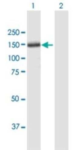 Thrombospondin-4 Antibody, Novus Biologicals 0.05 mg | Buy Online | Novus Biologicals | Fisher Scientific