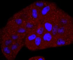 Thymidine Kinase 1 Rabbit anti-Human, Mouse, Clone: JF0970, Novus Biologicals