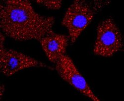 Thymidine Kinase 1 Rabbit anti-Human, Mouse, Clone: JF0970, Novus Biologicals