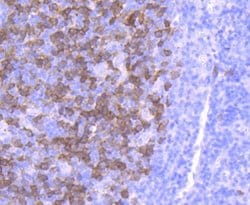 Thymidine Kinase 1 Rabbit anti-Human, Mouse, Clone: JF0970, Novus Biologicals
